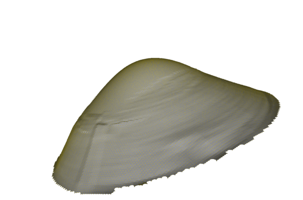 3D Visualisierung der Augenoberfläche aus den CSP-Messdaten der Pentacam AXL Wave