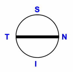 Zwei individuelle Sektoren einer Kontaktlinse