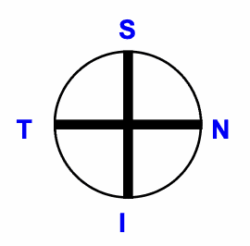 Vier individuelle Sektoren einer Kontaktlinse in Freiform-Fertigungstechnologie