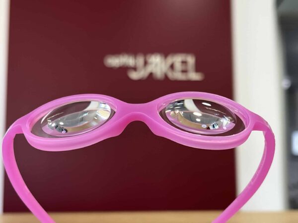 Lenti-Starbrillengläser bei Aphakiebrille